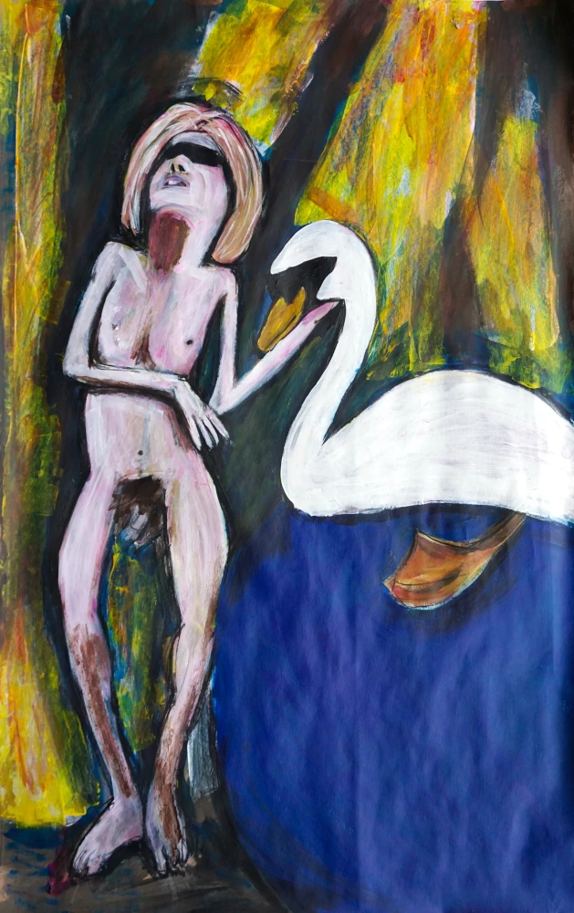 Painting by Chris Dale of Sandie Crisp standing beside swan, their polio disfigurement body contrasts the legendary beauty symbol.