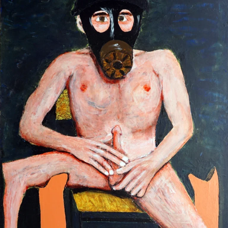 Trauma with white socks on Prosthetic.