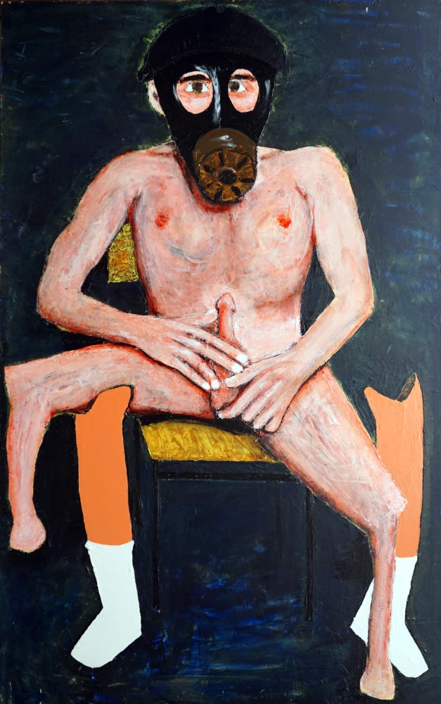 Trauma with white socks on Prosthetic.